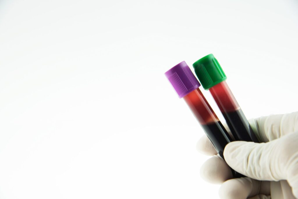 vacutainer blood collection tubes laboratory test min