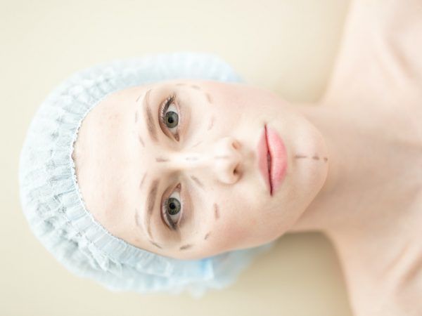 Cirugía facial