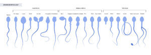 Seminograma: Morfología de los espermatozoides