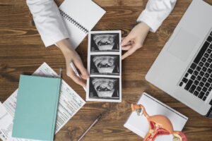 Mujer sosteniendo una ecografía en una clínica de fertilidad asegurandose de los síntomas de una buena implantación embrionaria
