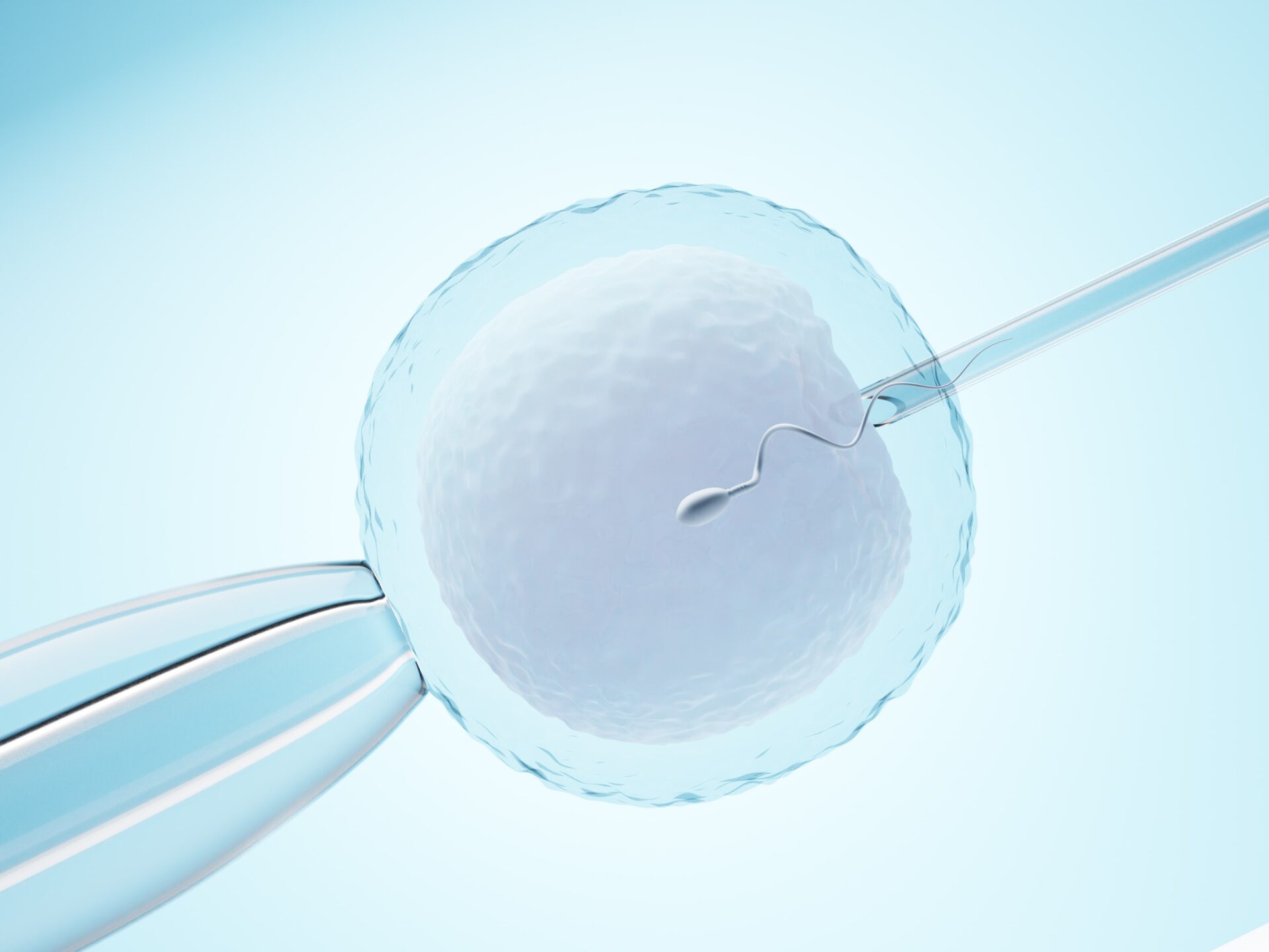 Diagnostico Genético Preimplantacional (PGT-A)