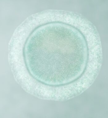 fecundation human ovule with sperms min fecundation human ovule with sperms min
